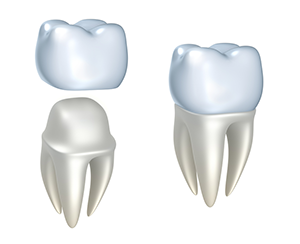 Dental Crowns | Pediatric Dentist in Cumberland, RI | Dental Associates of Cumberland